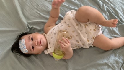 小西瓜打完疫苗后发烧了